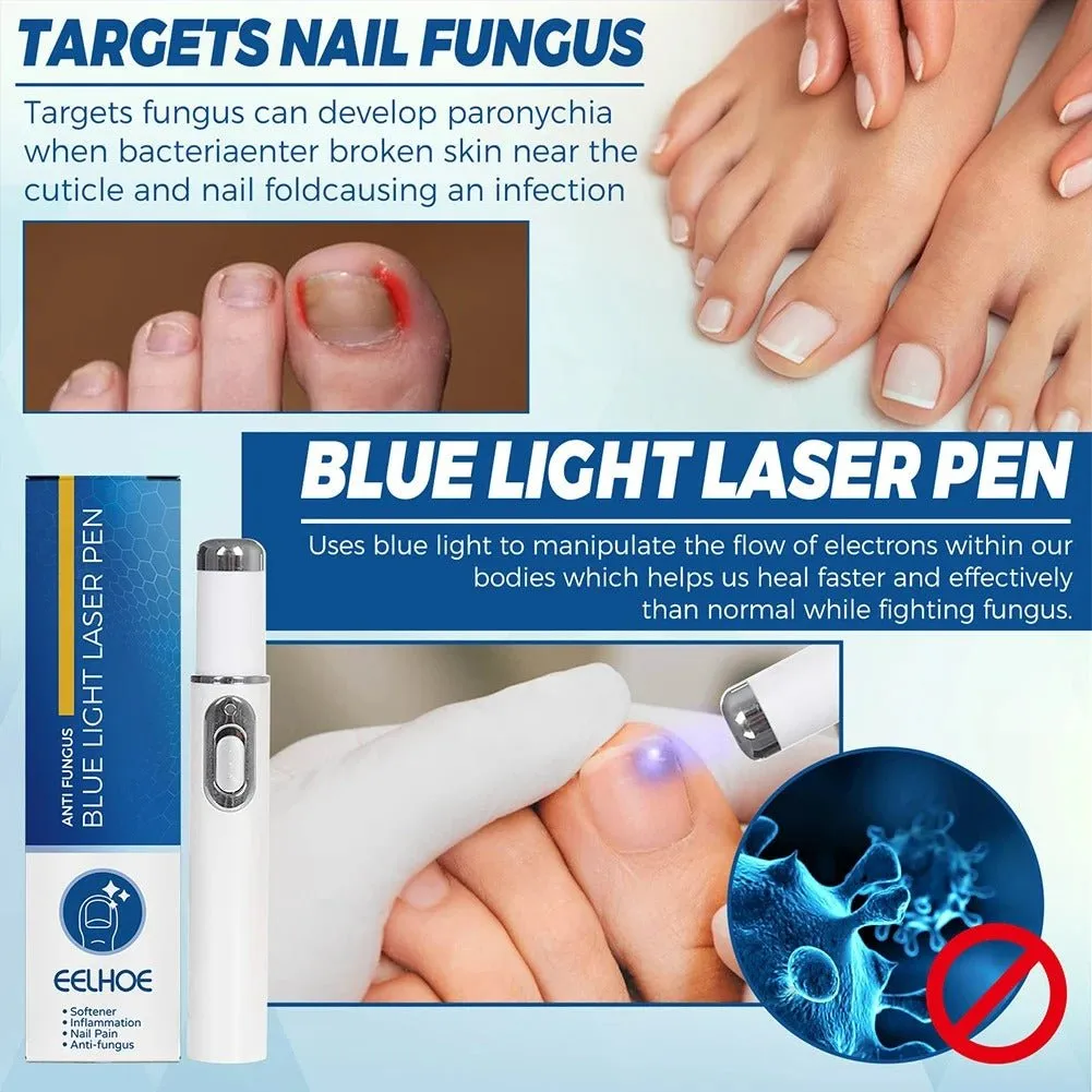 Antifungal Laser Device - Nail Fungus Treatment Pen Anti-fungal Repair Pen Blue Light Laser Pen