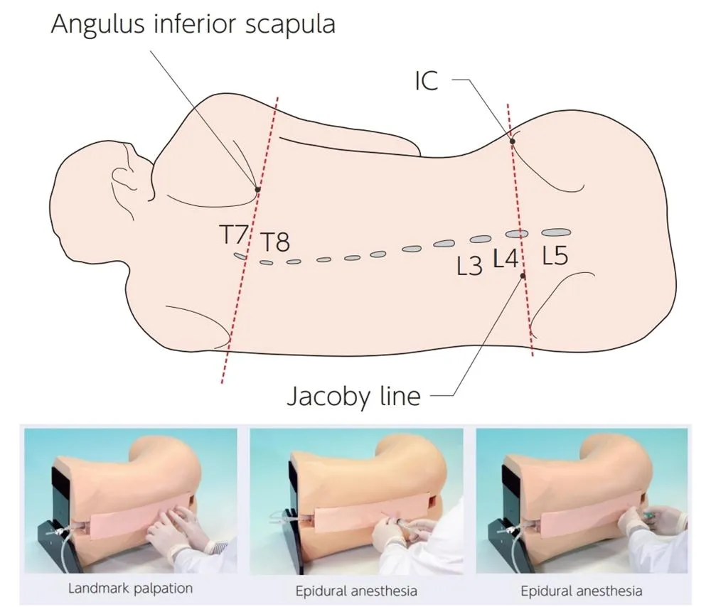 Epidural Anesthesia Simulator